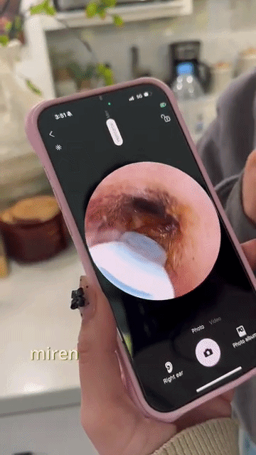 ¡Deja de limpiar tus oídos a ciegas! Mira todo en tiempo real desde tu celular 📱